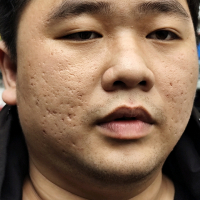 An Nguyen